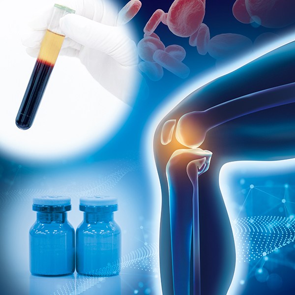 PRP療法（PFC-FDTM療法）とは
